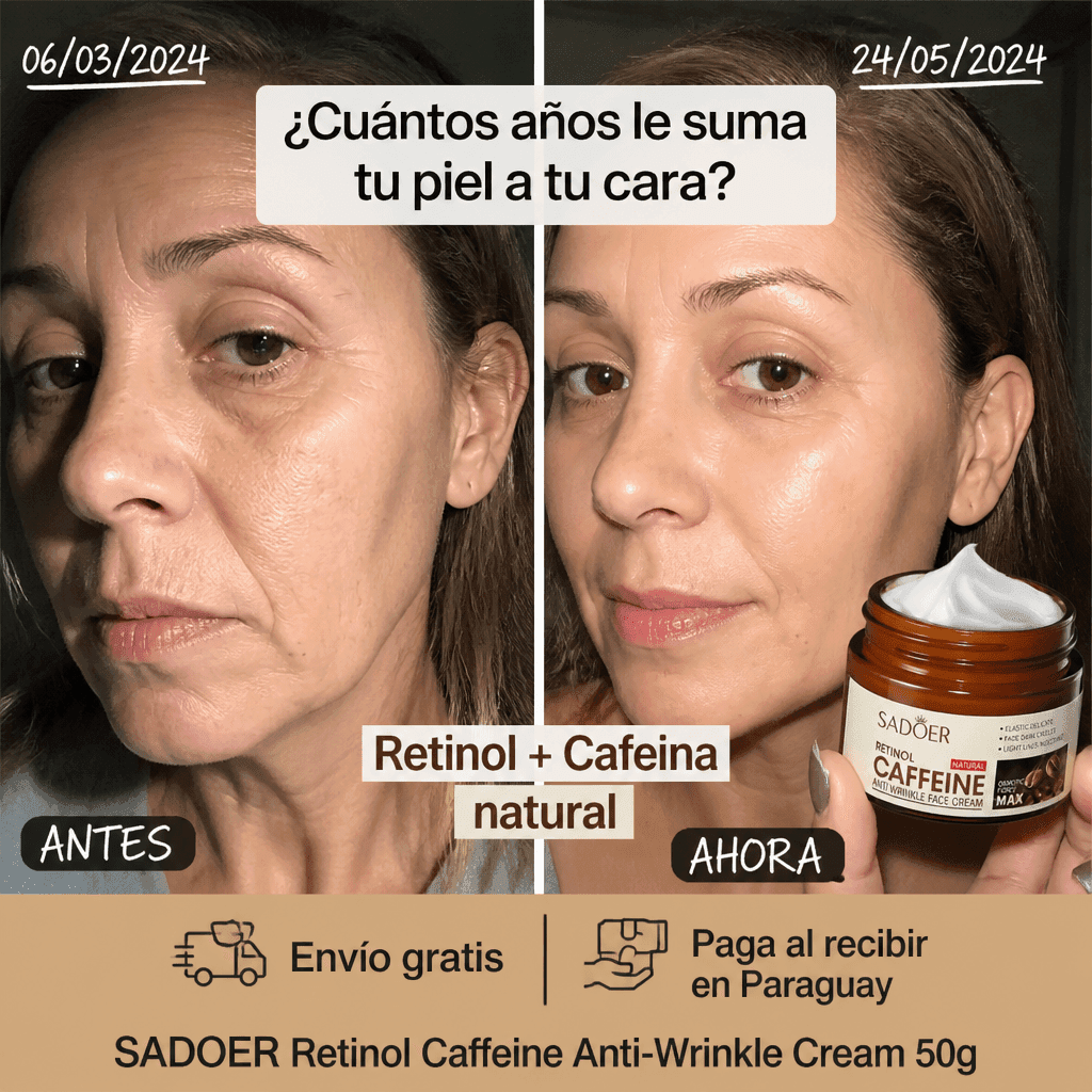 SADOER Retinol Caffeine Anti-Wrinkle Cream – Crema Antiedad con Retinol y Cafeína 50g — 2
